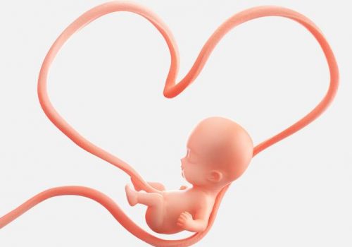 mi_bebe_esta_enredado_con_el_cordon_umbilical_es_peligroso_4605_orig